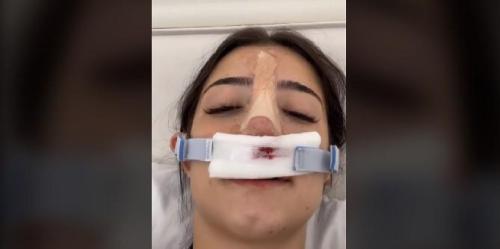 Charli D Amelio, estrela do TikTok, revela por que fez cirurgia