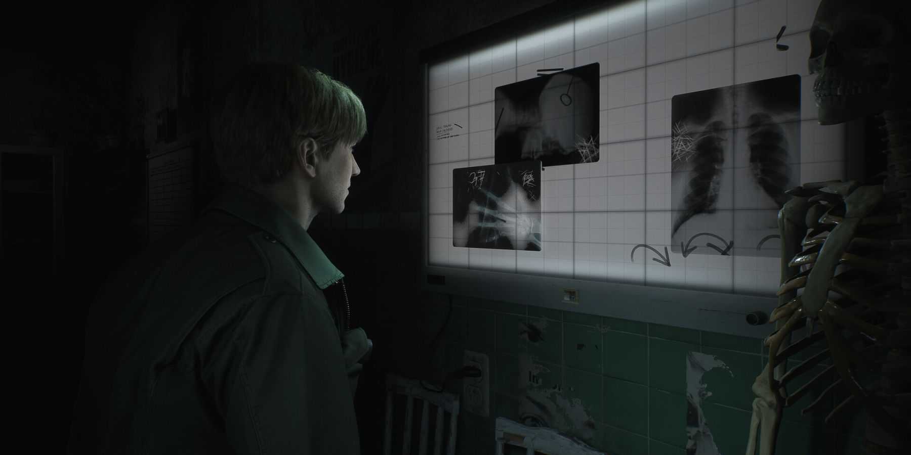 Arte-chave de Silent Hill 2 Remake James na sala de raio-x